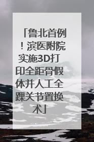 鲁北首例！滨医附院实施3D打印全距骨假体并人工全踝关节置换术
